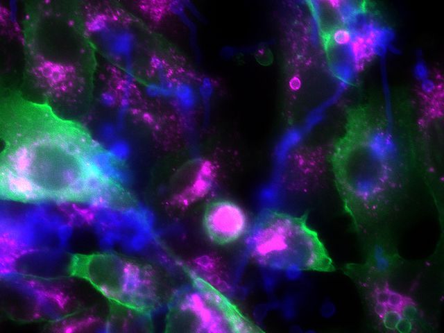 Fluoreszenzmikroskopisches Foto von Epithelzellen und Pilzsporen
