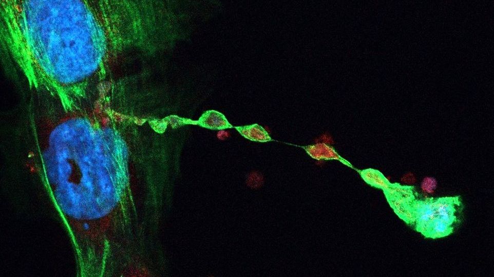 Mikroskopaufnahme von Mitochondrien in T-Zellen