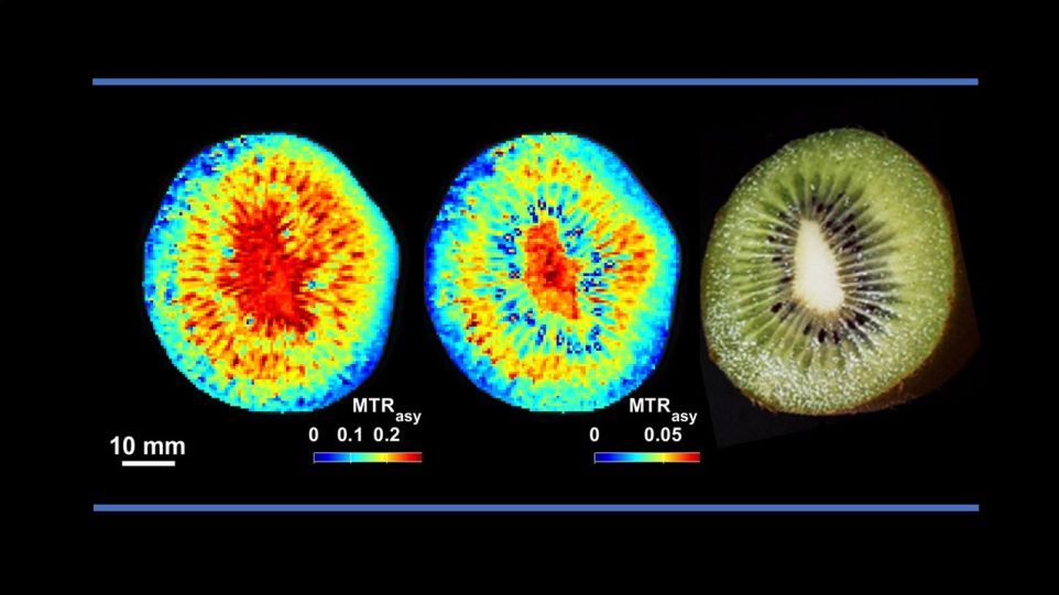 MRT-Bild einer Kiwi