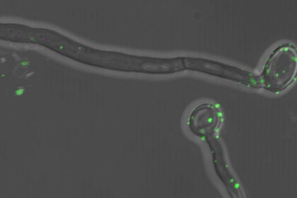 Immunabwehr mit Kehrseite